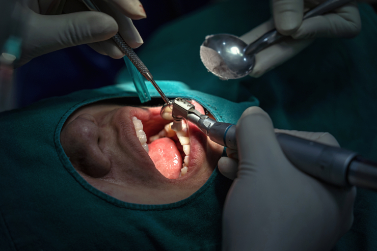 oral surgery